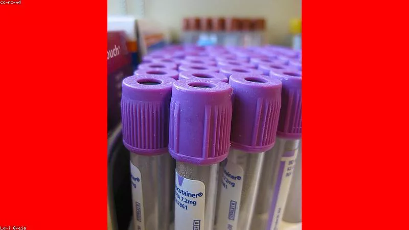 Cialis liều dùng 5mg hàng ngày hỗ trợ điều trị phì đại tuyến liệt